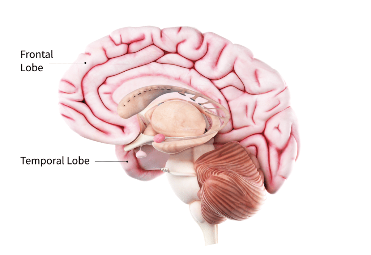 what-are-frontotemporal-disorders-causes-symptoms-and-treatment